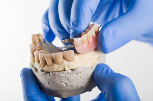 Dental Implants vs. Dentures: Which Tooth Replacement Option Is Right for You?