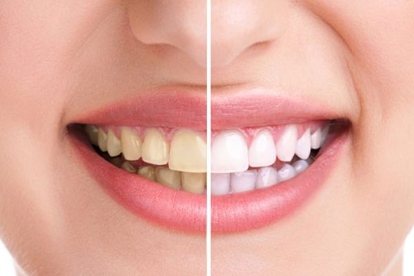 ba-ddl-dental-unsmushed
